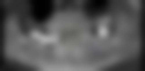 结尾预约号召:立即行动,拥抱健康笑容