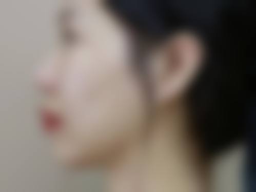 透明收费标准与近期优惠活动详情