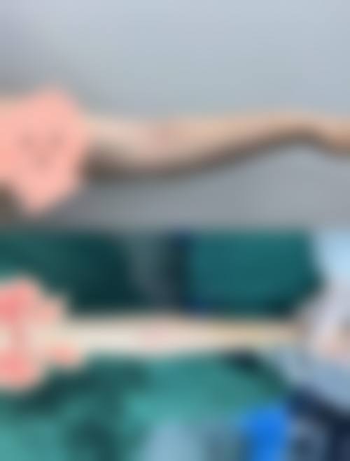 临床实例分享