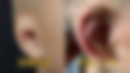 诊疗特色总结：为什么选择高新静欣医疗美容？