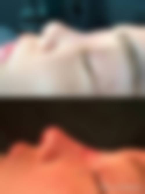 患者真实评价：常熟圣莎拉医疗美容门诊部王丽莎