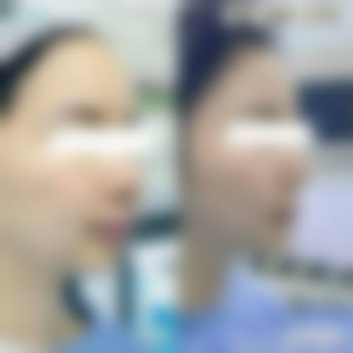 结尾预约号召：常熟圣莎拉医疗美容门诊部王丽莎