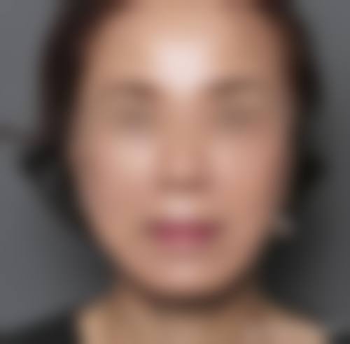 临床实例分享：找宋遵理医生能达到理想成效吗？