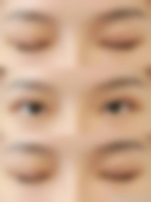 擅长项目详解：常熟圣莎拉医疗美容门诊部王丽莎