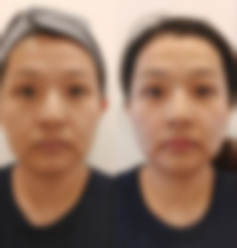 擅长项目详解