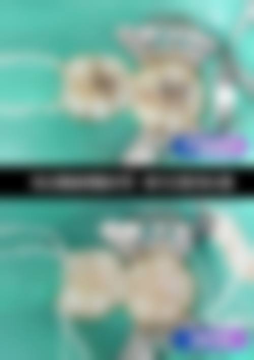 五、深圳诺德齿科(西丽店)收费价格表