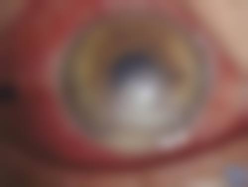 价格透明与服务优惠：高性价比的眼科选择