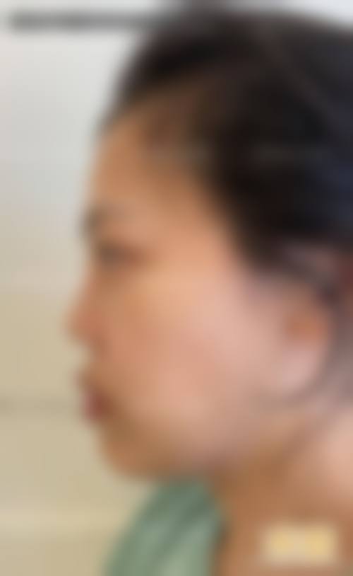 临床实例分享
