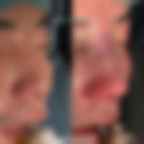 患者真实评价深圳呈悦医疗美容门诊部沈想仁
