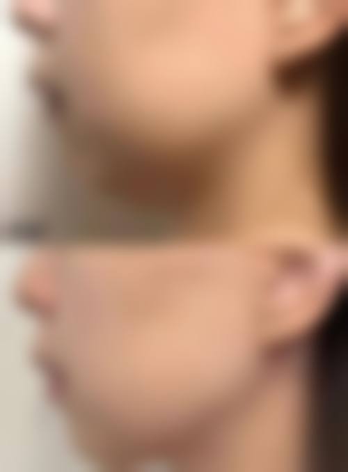 医生资质介绍深圳呈悦医疗美容门诊部沈想仁