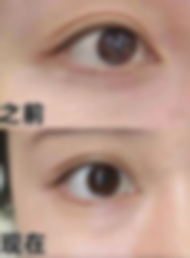 擅长项目详解：南昌大学第二附属医院王朝慧医生技术特色