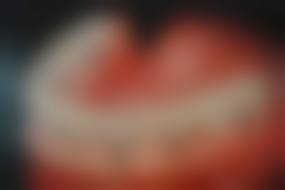 总结与预约号召