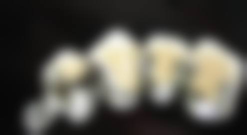 预约优惠活动:有什么补贴?