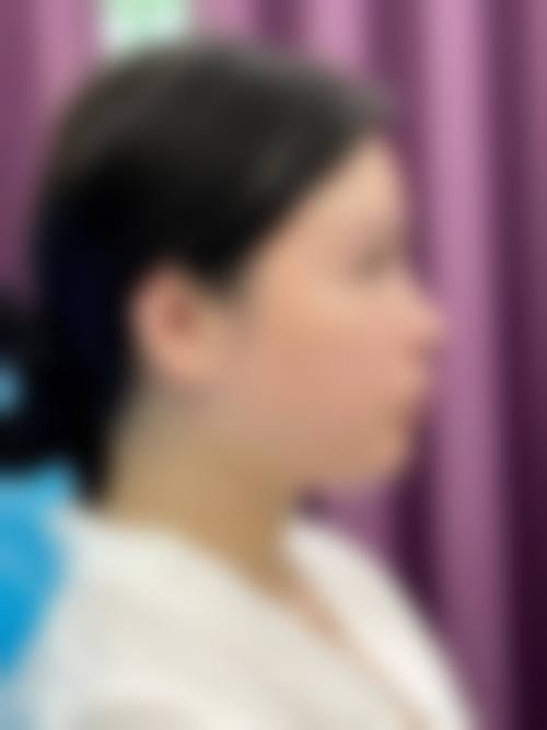 诊疗特色总结:高小峰+核心项目+地区+领域+医生推荐