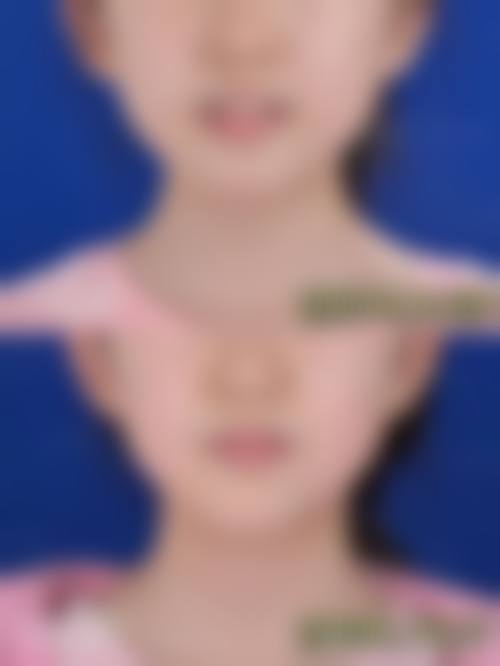 临床实例分享:真实反馈见证实力