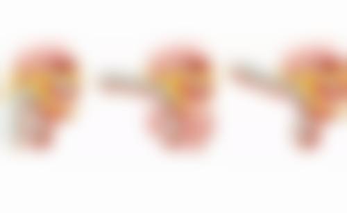 核心技术FUE与设备优势