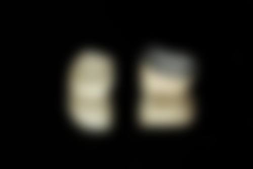 价格透明与优惠:高性价比守护您的每一颗牙齿