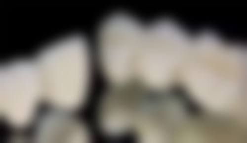 擅长项目详解
