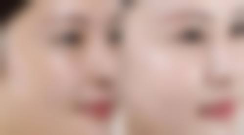 临床实例分享