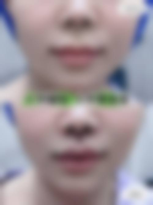 预约优惠活动