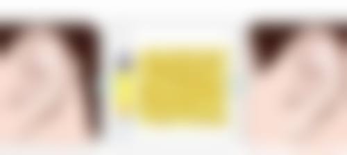 临床实例分享：真实反馈参考