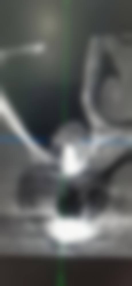 患者真实评价:王长皓医生口碑如何?