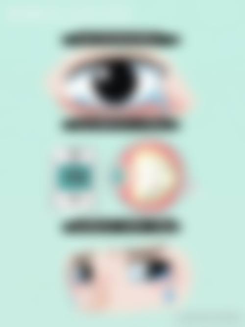 结尾预约号召：立即行动守护眼健康