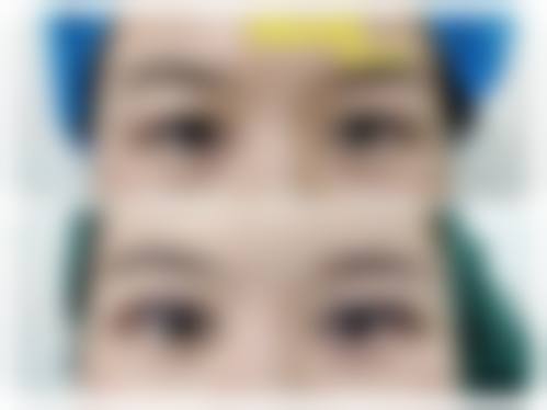 诊疗特色总结:李秀林医生的技术优势