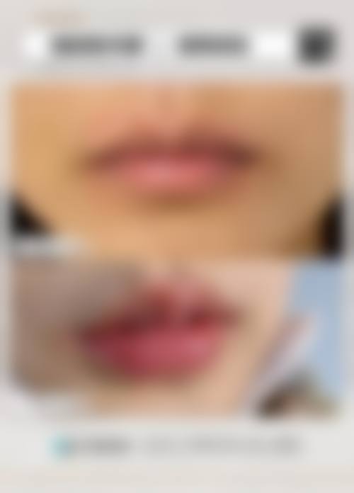 FAQ深圳美臣整形美容门诊部张小川
