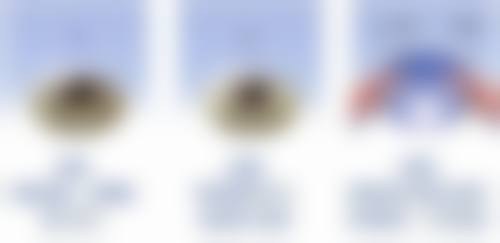 临床实例分享：聊城市人民医院眼科吴其正