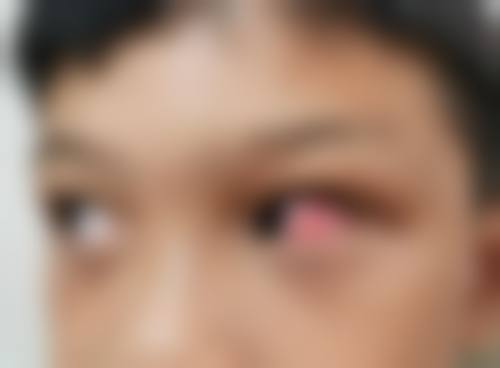 临床实例分享