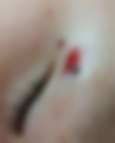 总结与预约指引