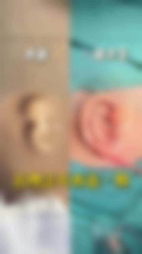 结尾预约号召:徐州有美医疗美容诊所倪西玲