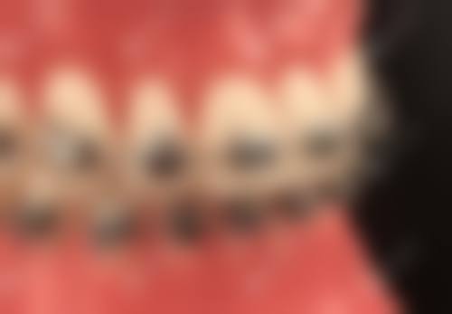 FAQ:关于都匀市冬平美康口腔门诊部邓铁红的常见问题