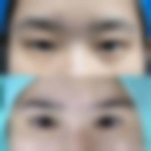 结尾预约号召广元市第一人民医院眼科