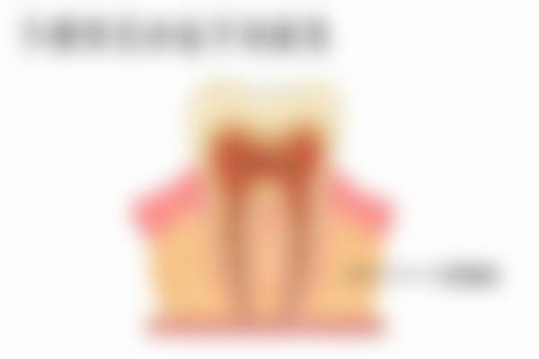 五、广州曙光美云口腔Norman von Sternberg医生技术怎么样?