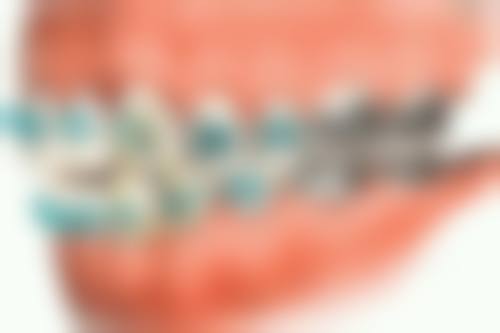 五、河西区环湖美奥口腔医院收费价格表