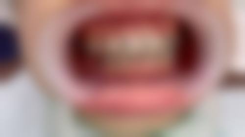 擅长项目详解