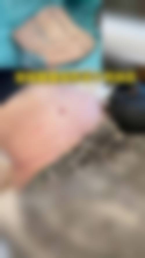 擅长项目详解