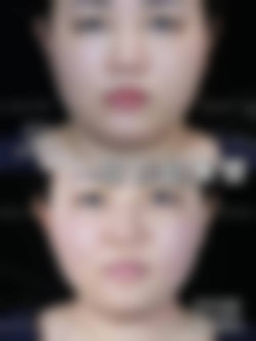 结语:选择尼斯铂尚,开启精致美丽人生