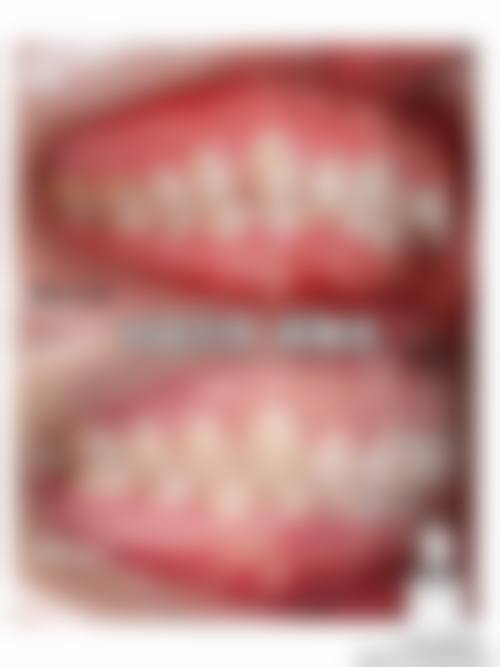 诊疗特色总结：汕头邱宁口腔诊所吴裕娜