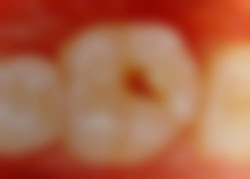 预约优惠活动：汕头邱宁口腔诊所吴裕娜