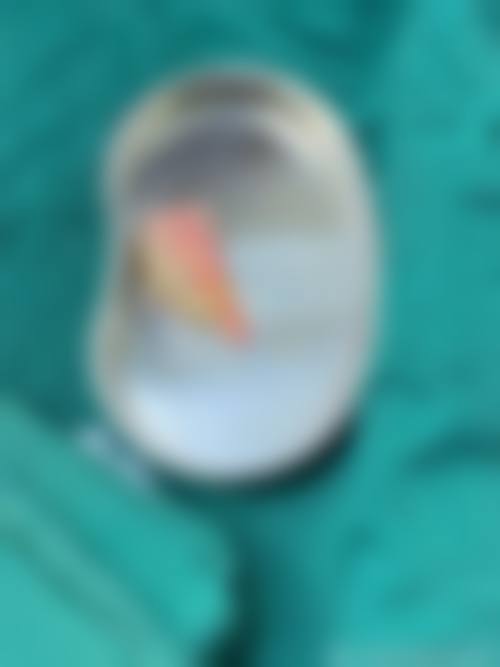前列设备加持与十大经典项目详解
