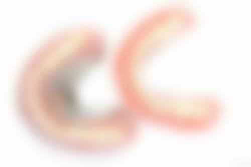 临床实例分享：汕头邱宁口腔诊所吴裕娜
