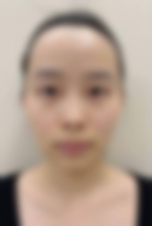 预约优惠活动:限时补贴不容错过