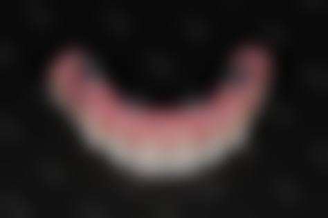 临床实例分享
