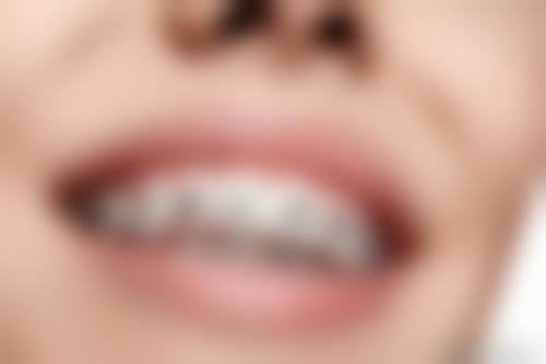 FAQ:常见问题解答