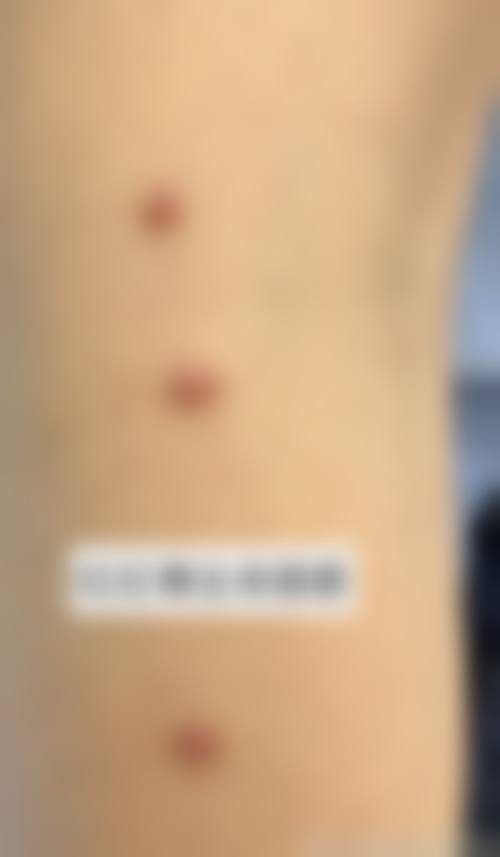 热门项目价格表：透明收费拒绝隐形消费