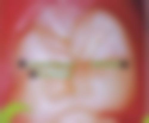 结尾预约号召:立即行动重获好牙口