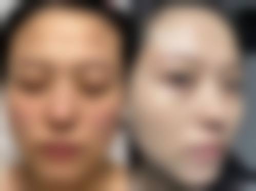 患者真实评价